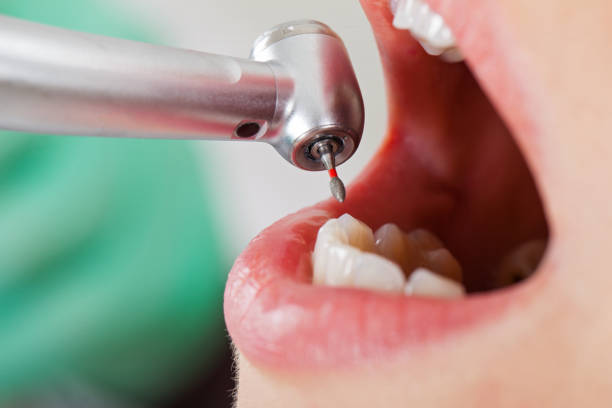 Best Emergency Dental Services for Seniors in Dauphin, PA